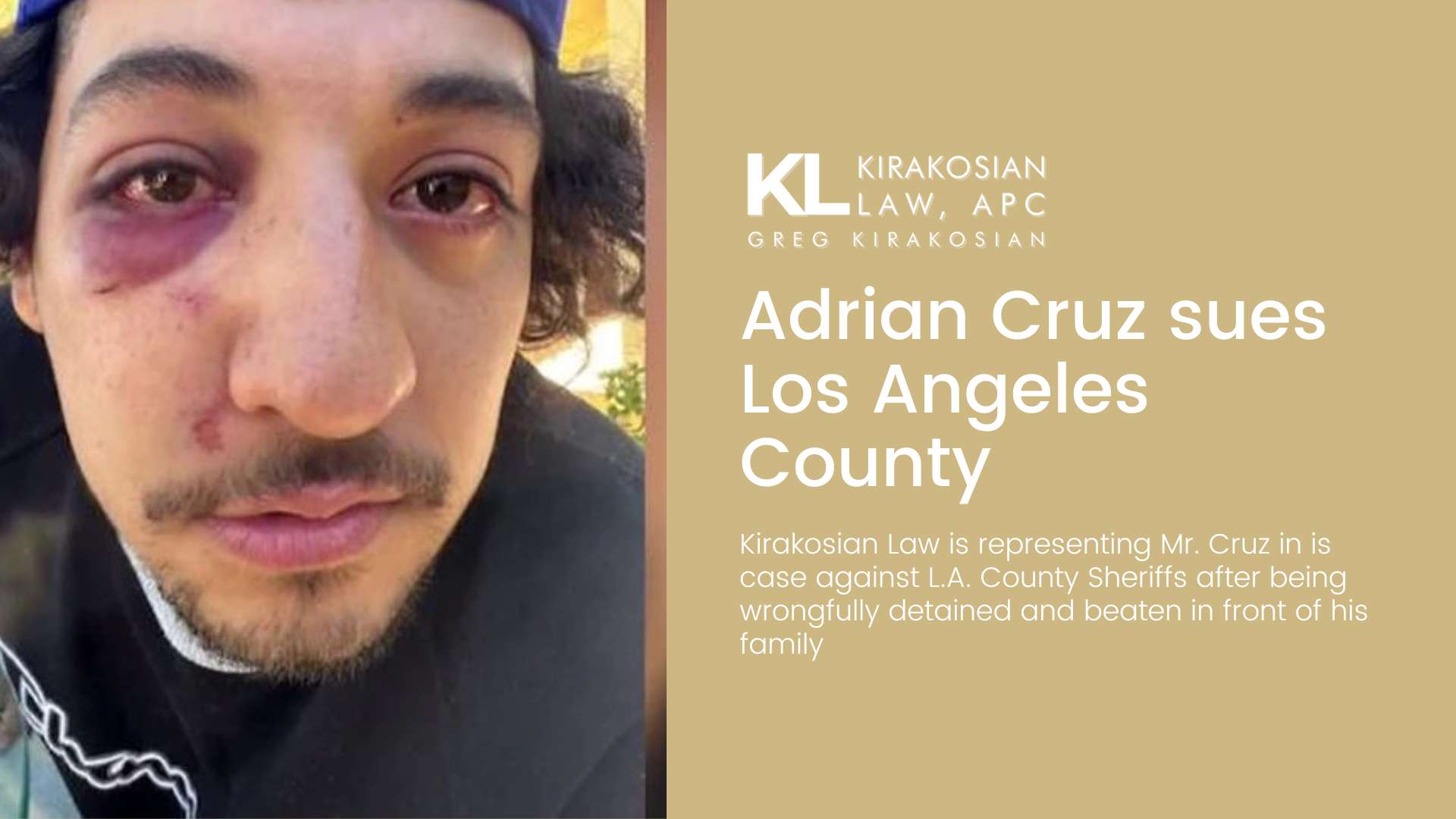 Adrian Cruz wrongfully detained and beaten by Sherriff's Deputies