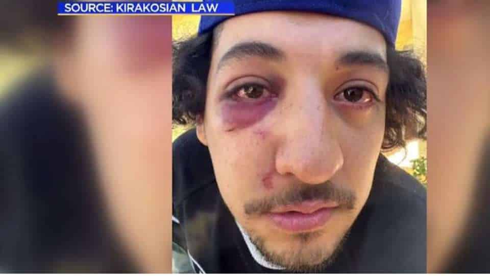 Adrian Cruz beaten by deputies