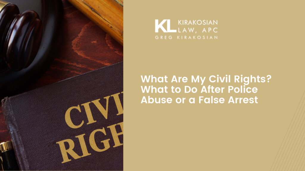 What Are My Civil Rights? What to Do After Police Abuse or a False Arrest 7 What Are My Civil Rights? What to Do After Police Abuse or a False Arrest
