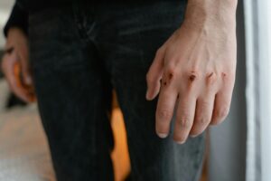 Suing for False Charges: Can You Sue the County for False Charges? 2 What Damages Are Available to Victims?